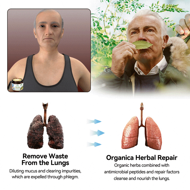 𝐌𝐈𝐐𝐈𝐊𝐎® 𝐌𝐨𝐫𝐢𝐧𝐠𝐚 𝐋𝐮𝐱𝐞 𝐋𝐮𝐧𝐠 𝐑𝐞𝐯𝐢𝐯𝐞 𝐁𝐚𝐥𝐦🏆🏆(👨‍⚕️𝐑𝐞𝐜𝐨𝐦𝐦𝐞𝐧𝐝𝐞𝐝 𝐛𝐲 𝐋𝐅𝐀 𝐟𝐨𝐫 𝐎𝐩𝐭𝐢𝐦𝐚𝐥 𝐑𝐞𝐬𝐩𝐢𝐫𝐚𝐭𝐨𝐫𝐲 𝐇𝐞𝐚𝐥𝐭𝐡👨‍⚕️) 𝐋𝐚𝐬𝐭 𝐃𝐚𝐲 𝐏𝐫𝐨𝐦𝐨𝐭𝐢𝐨𝐧 𝟖𝟎% 𝐎𝐟𝐟