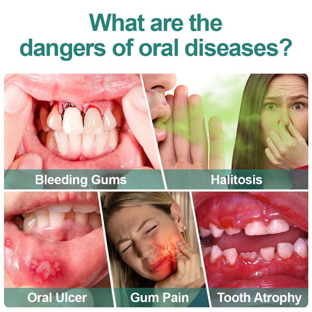 Furzero™ Herbal Mouth Spray