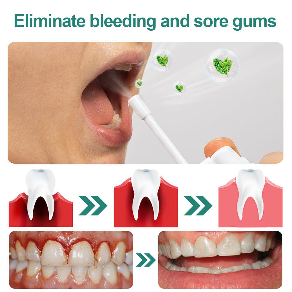 Furzero™ Herbal Mouth Spray